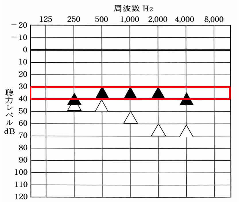▲が補聴器装用時。△が補聴器非装用時。補聴器は、補える人でだいたい30〜35dBくらいまで補える。