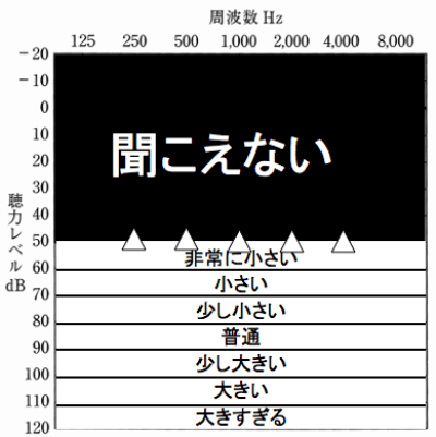 聴力検査は、最小可聴閾値で評価するため、数値より上は、聞こえない