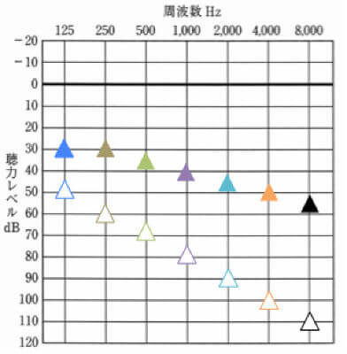 補聴器による改善値オージオグラム版