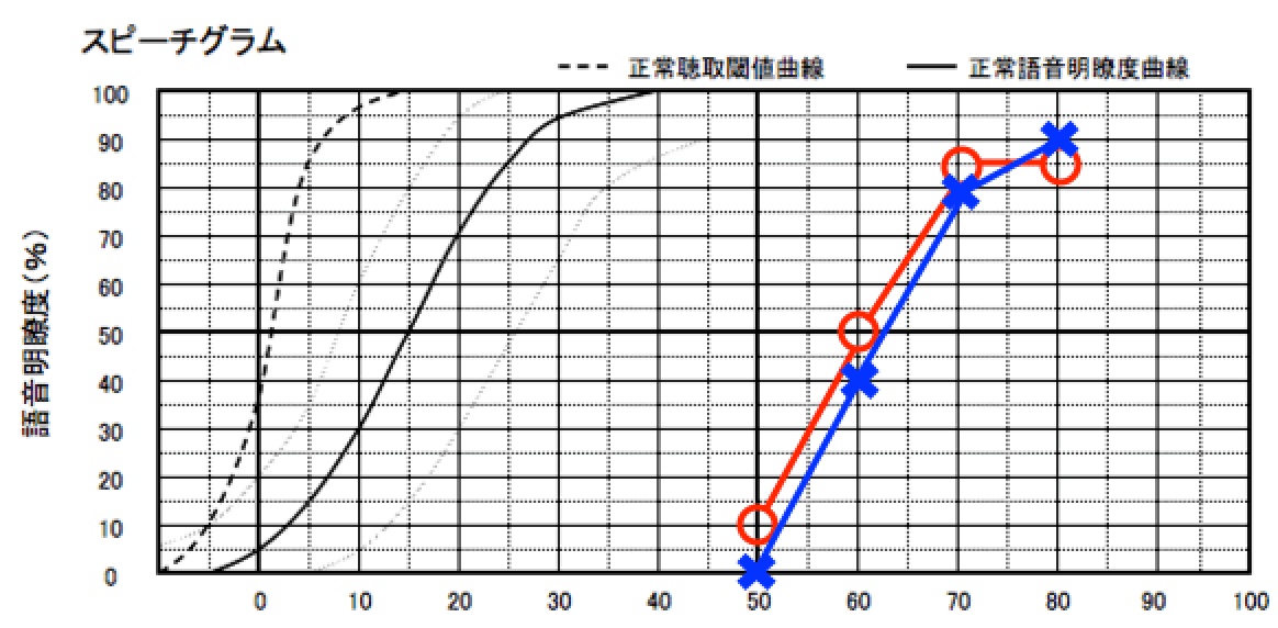 耳には、音の理解力というものがある。それを調べた図。こちらは、両耳とも音を入れる事で、音の理解が上がっている事を示す