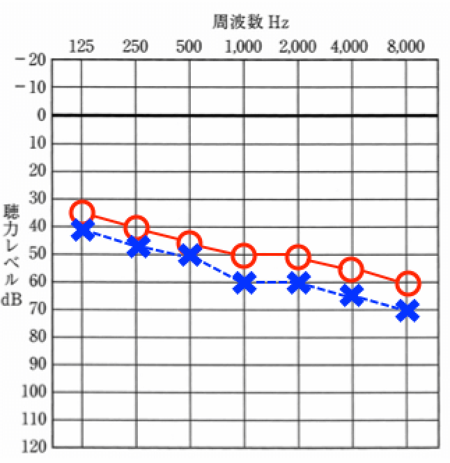 このような図で表示されるのが、聴力です。この聴力はあくまでもイメージとなります。
