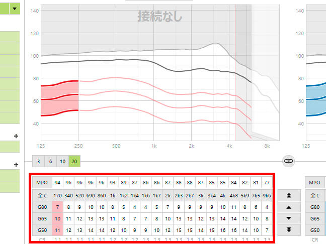 20chは圧巻である。これだけ細かく調節ができる補聴器もある