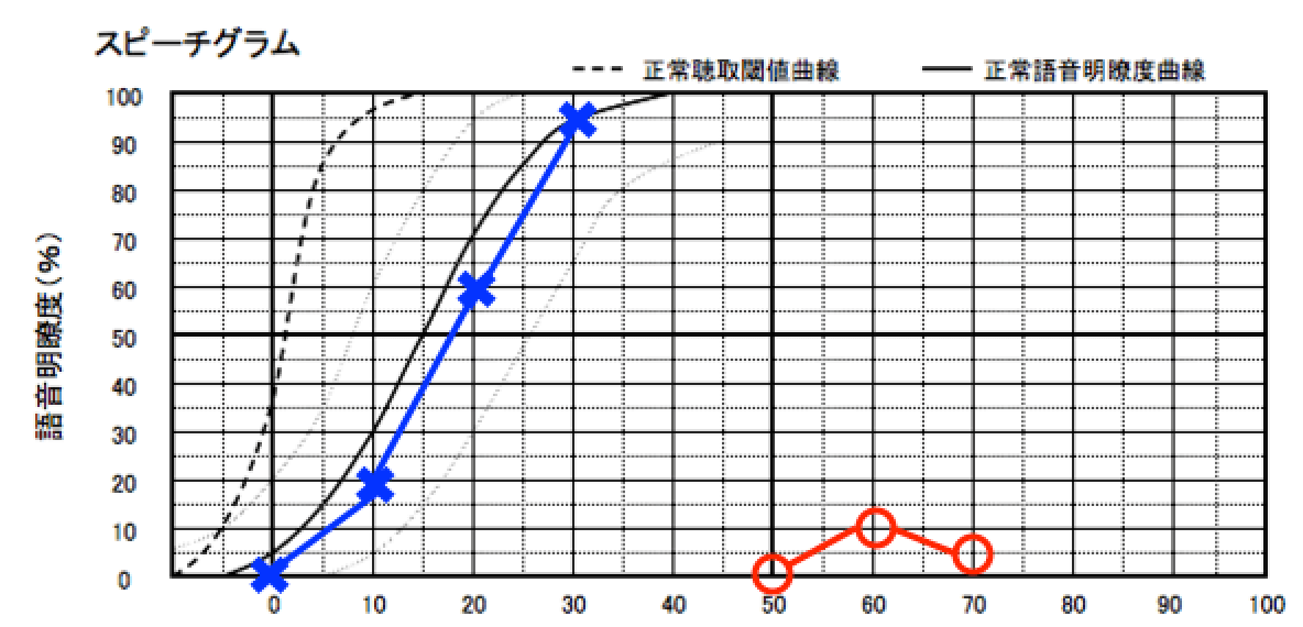 こちらの見方は、縦軸が正解率、横軸が音の大きさ。音を入れることでどれだけ理解できるかを見る図であり、60%を超えないとその耳に補聴器を装用しても、効果が薄い。