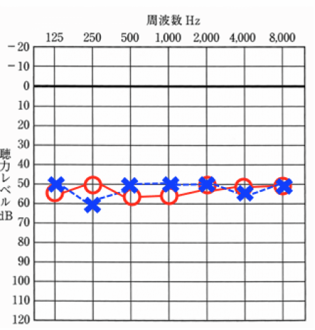 多チャンネルでなくても大丈夫な聴力