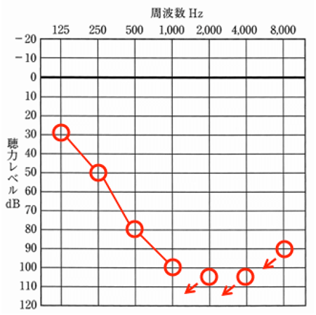 チャンネルがあると嬉しい聴力