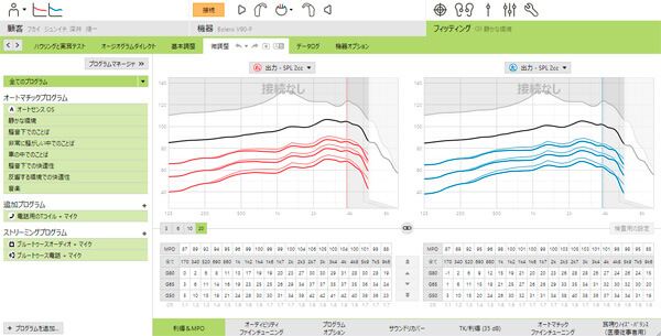 補聴器の調整画面、細かく写っているのがチャンネル