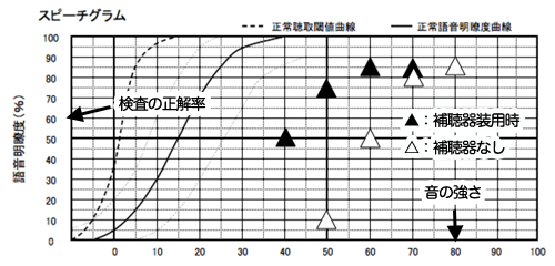 語音明瞭度測定結果の見方