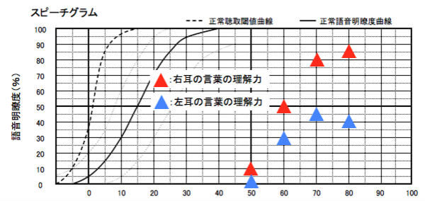 各耳の語音明瞭度を表す図