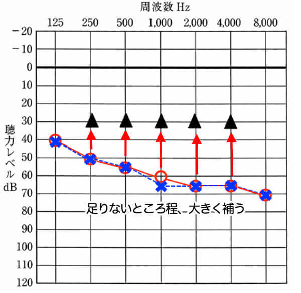 補聴器は聞こえにくい音ほど補う