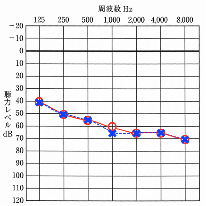 ブログ運営人の聴力