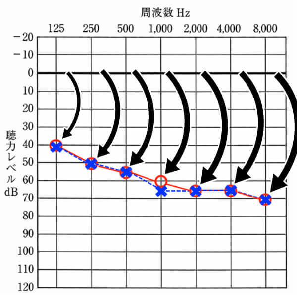 私の聴力図と聴力低下具合