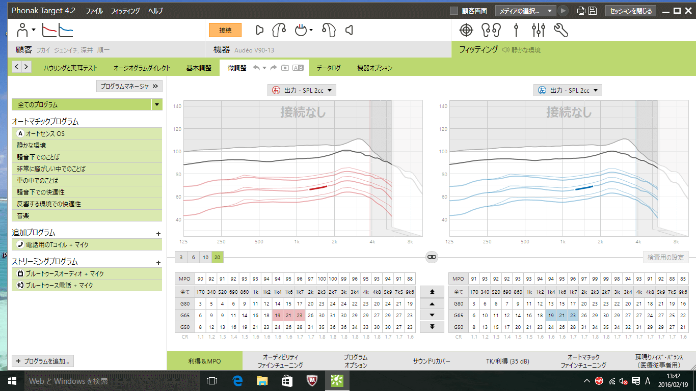 こんな部分だけを調整できちゃうのが補聴器