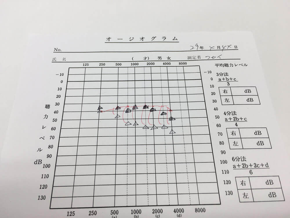 補聴器を装用した状態を可視化するものも同様。この数値と目標となる数値、そして、体感を伺いながら、改善できるだけ改善させていく。そのような対応を行なっています。