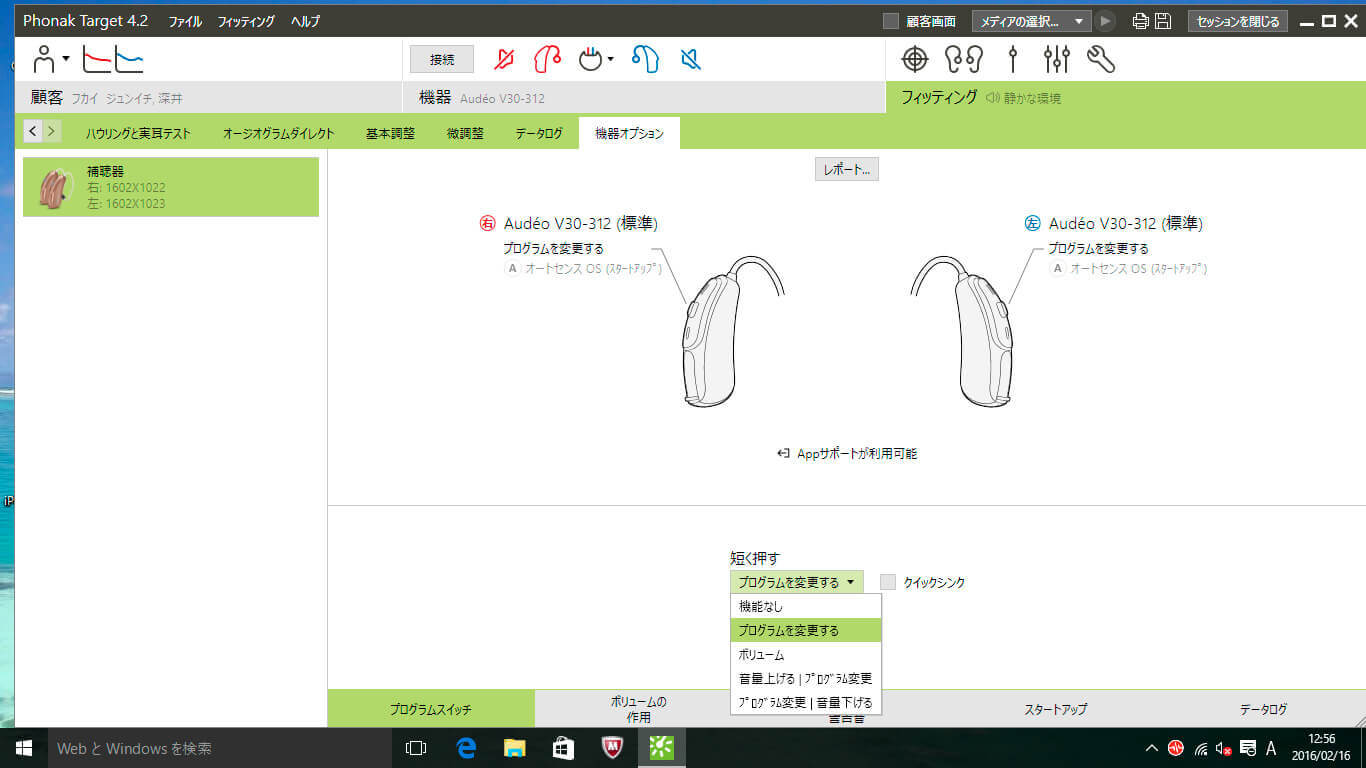 RIC補聴器の中には、ボリュームとプログラムスイッチが選べるものがある