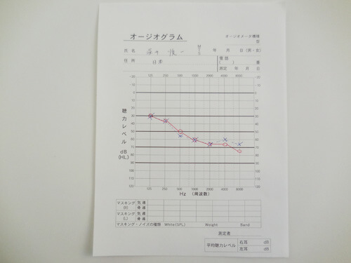 初めに聴力図を出す