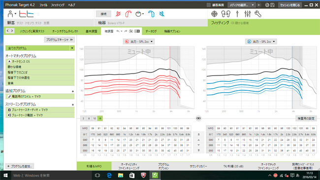 補聴器調整の例。補聴器は、基本的にパソコンで調整し、聴力に合わせ、周波数別に音量を大きくしていく。そのため、細かく周波数が分かれている。