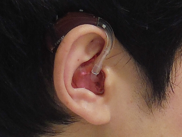使用している補聴器の右側