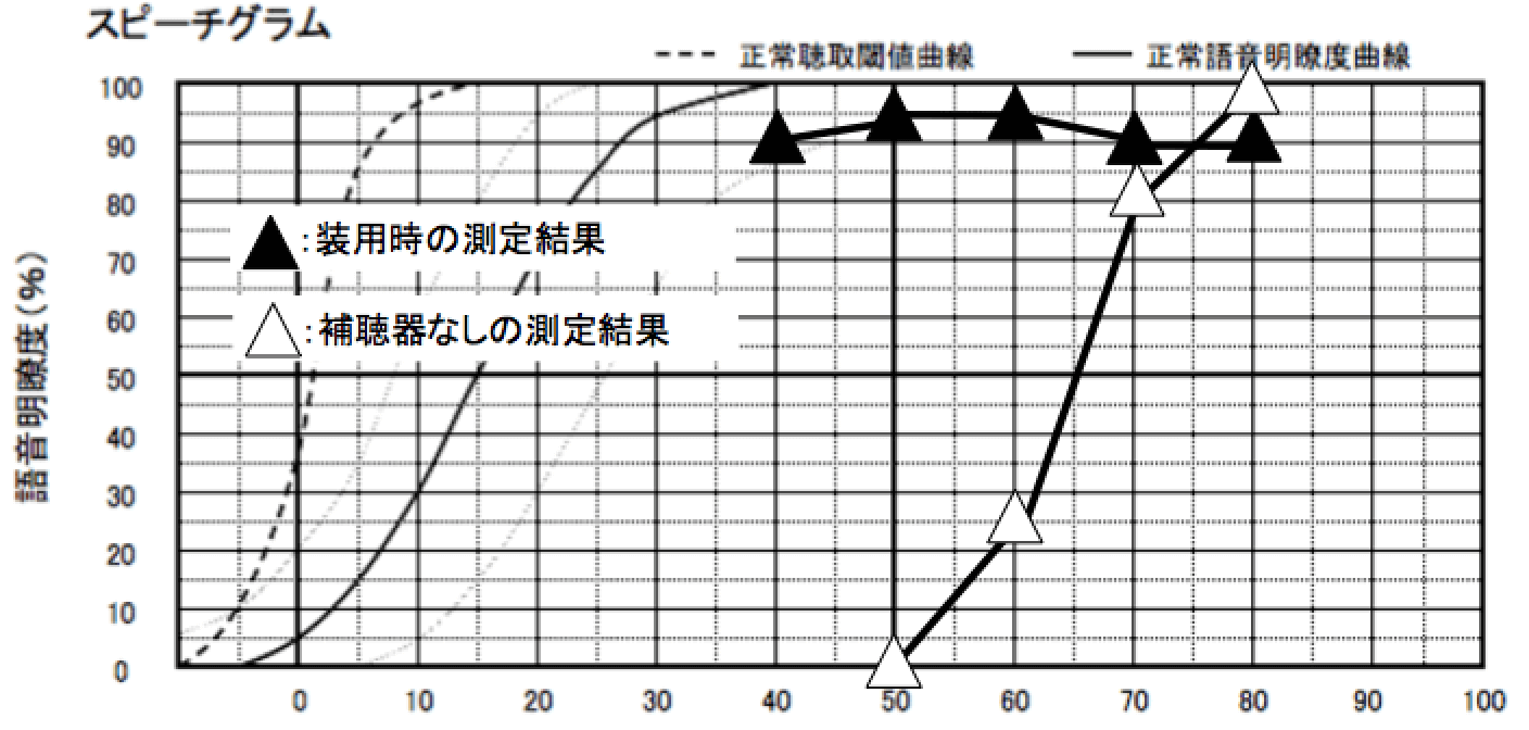 私の補聴器装用時と非装用時の結果