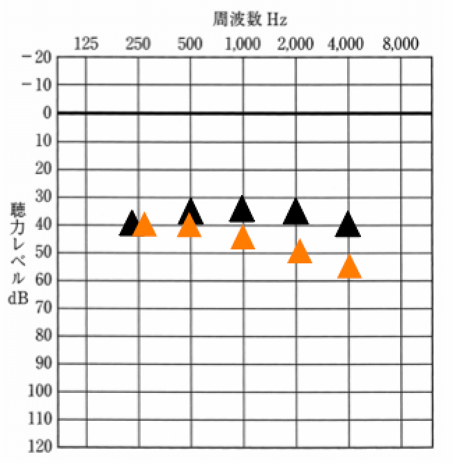 同じく測定例。黒が昔の聞こえ、オレンジが今の聞こえ