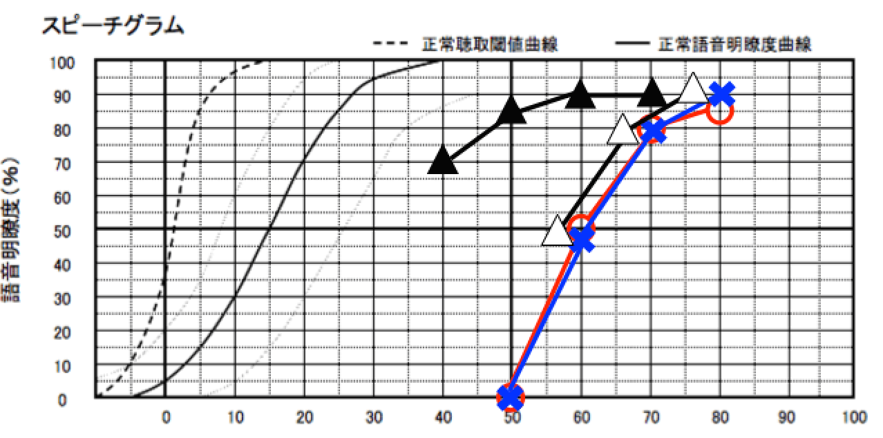 補聴器を装用した状態まで測定した図。こんな感じに色々と見れます。
