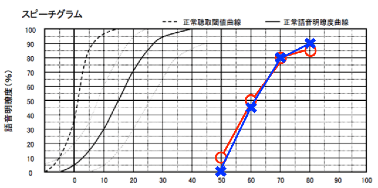 ヘッドほんで測った語音明瞭度測定。○と×は、それぞれ右と左を表す