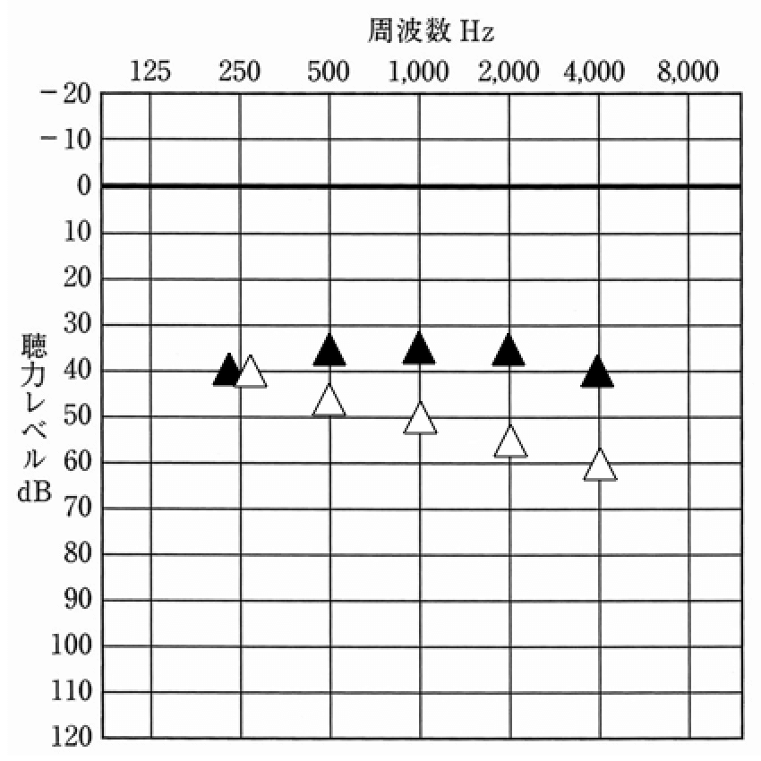 補聴器を装用した状態の聴力測定版。そのため、使われる表も聴力測定と同じ