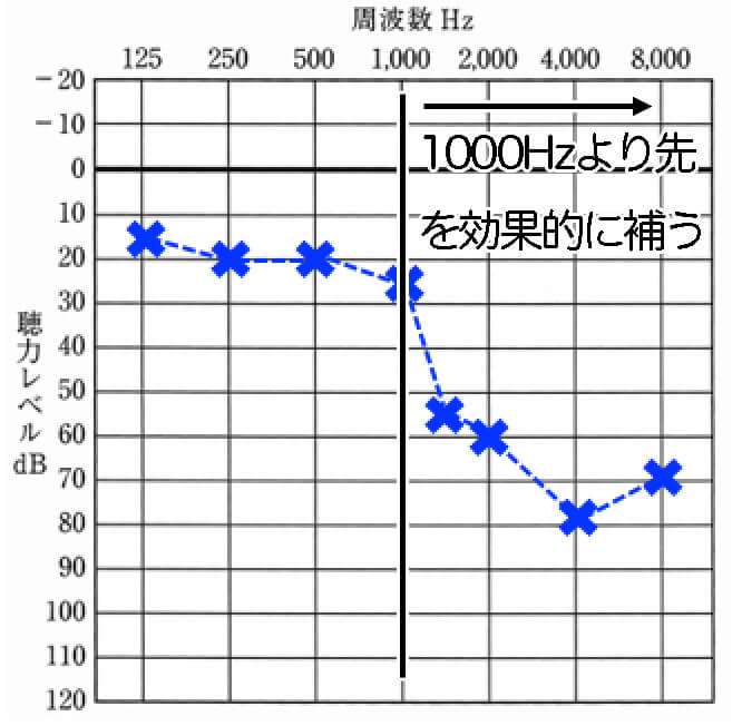 この補聴器が合うのは、1000Hzまで正常で、それ以上の高い音が聞きにくいケース。