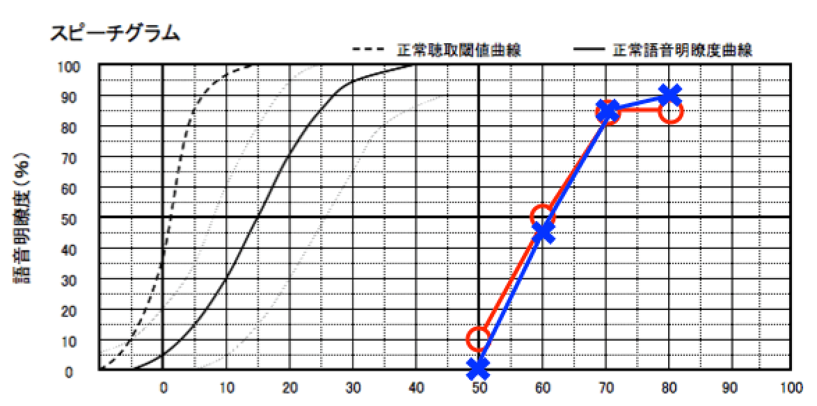 両耳の聴力が同じ場合は、明瞭度も同じ傾向がある。この場合は、両耳装用が良い