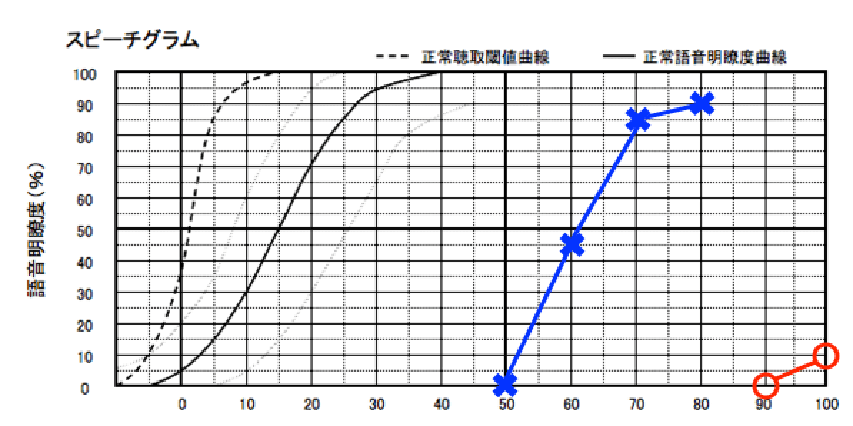 明瞭度が低い場合は、残念ながら音を入れても効果が薄い。このような場合は、バイクロスの方が不自由度を改善できる