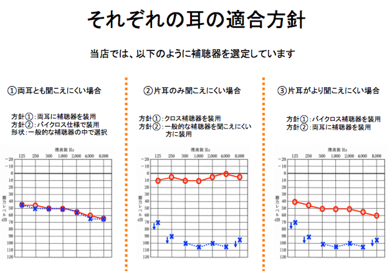当店における耳の補い方、耳には、音を入れて効果が出る耳とそうでない耳があるため、このように考えて聞こえを改善させる