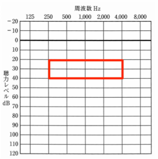人工内耳を装用して効果がでる範囲。かなり良い結果になるケースをいくつか見ている