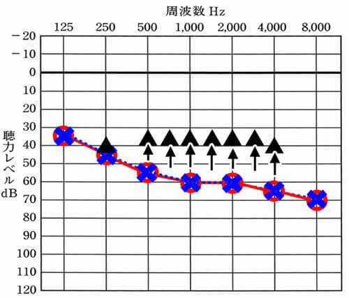 聞こえを補うイメージ。下がった聴力を補聴器を使って、より聞こえる様にしていく。
