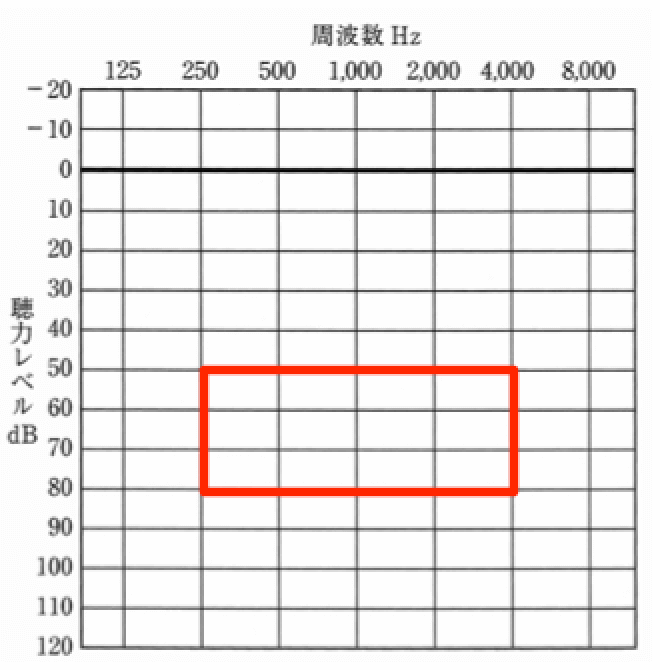 従来の補聴器で出せる効果、音声での理解は、かなり難しい数値となる