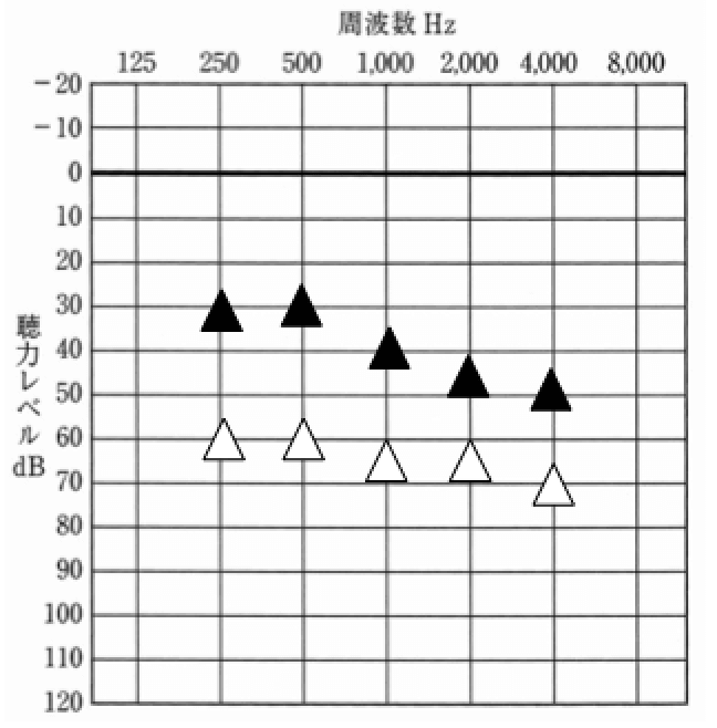 要注意の波形。フィッテング理論でもそうだが、あまり低域は、大きくしない。