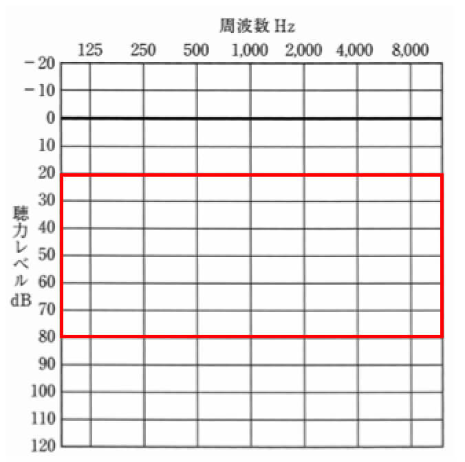 カナルの主な適応範囲。これよりも聴力が重い場合は、補いにくく、かつハウリングのリスクが飛躍的に高まる