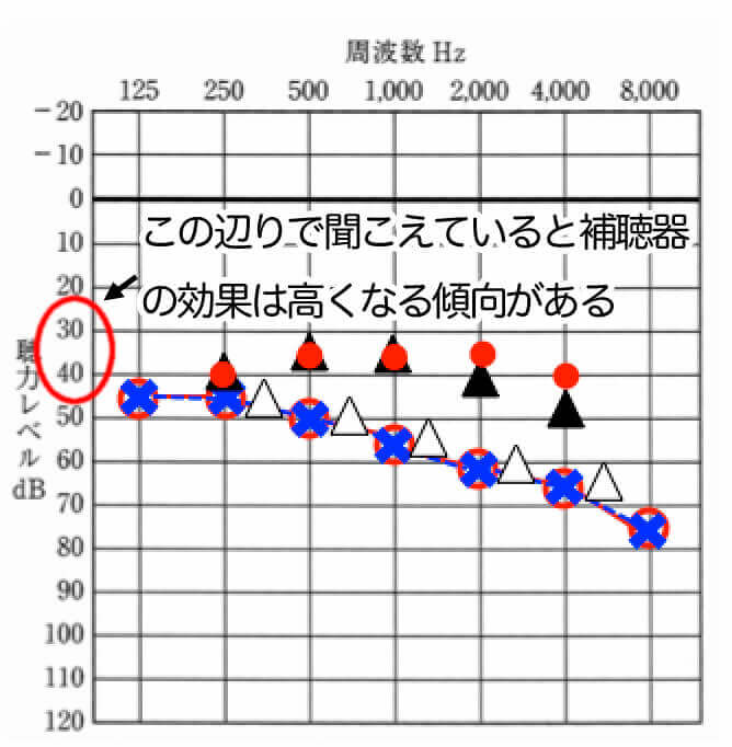 音声をしっかり理解できる聞こえのレベルは、決まっているので、基本的にそこを目指すのがセオリー