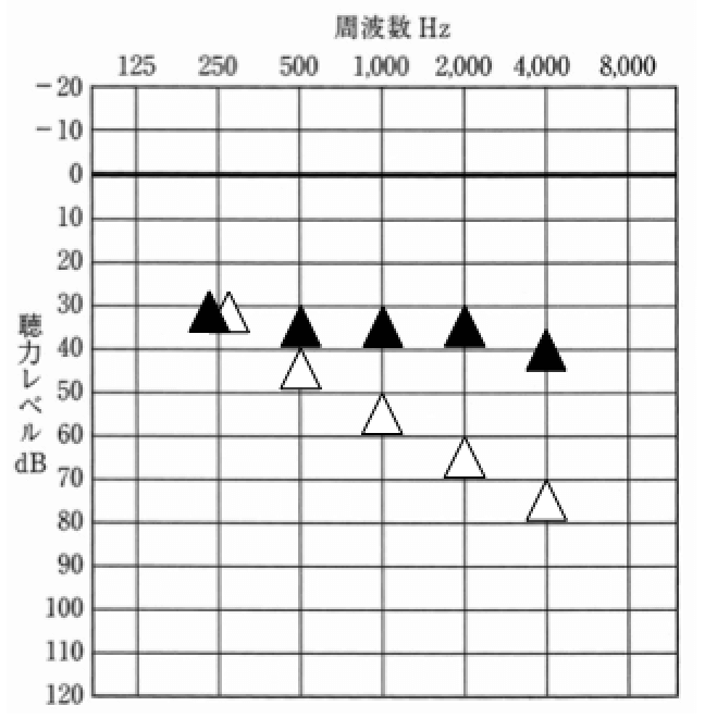 耳の状態を可視化できるものもあれば補聴器の状態を可視化できるものもある。この手のものは、実際には、数値をどう見るのか(判断するのか)。それが一番重要になる。