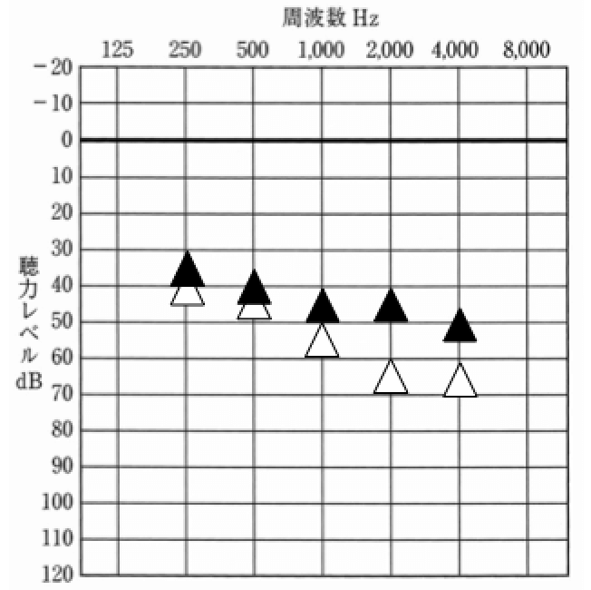初回の対応時、1000Hzは、目標より低いが、その他は、概ね良し。