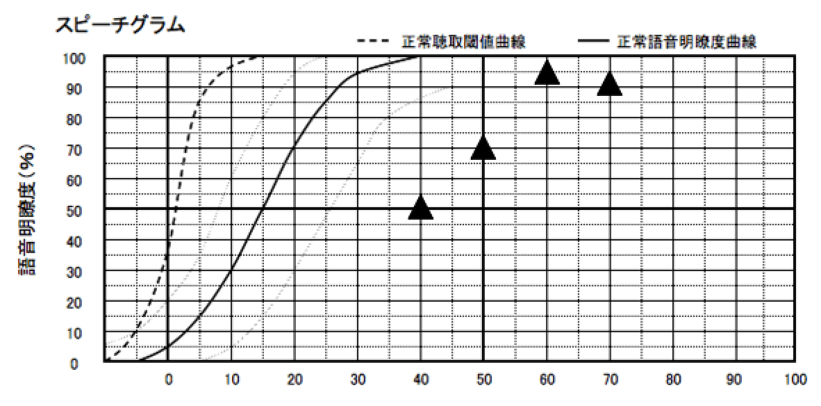 基本的に音場閾値の数値がある程度よくなると、こちらも良くなる傾向がある。
