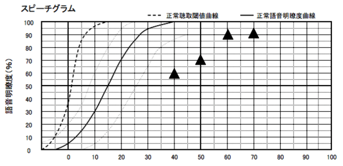 明瞭度も若干だが、良くなった。