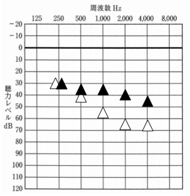 最終的には、このように。