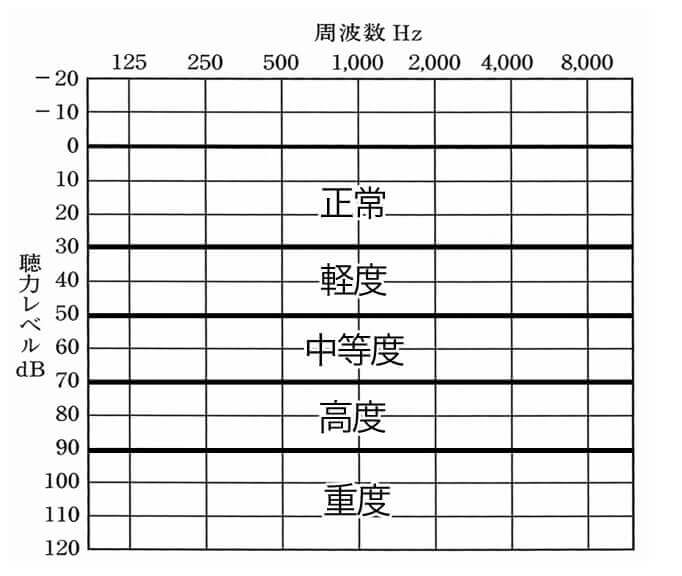 主な聴力レベル表。こちらで見ると状況がわかりやすい。