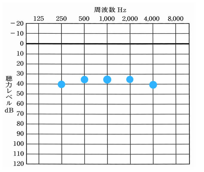 補聴器を装用して、聞こえを改善させる目安。こちらを見てもらうと、ある程度までしか、補聴器で改善できないことがわかる。