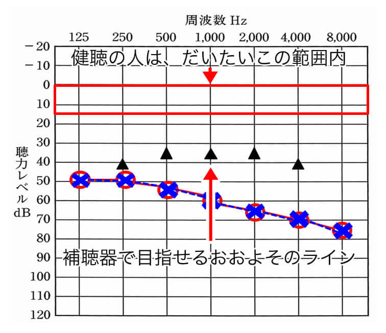 補聴器で聞こえを補えるラインと健聴の人の聞こえている範囲。大きく差があることがわかる。