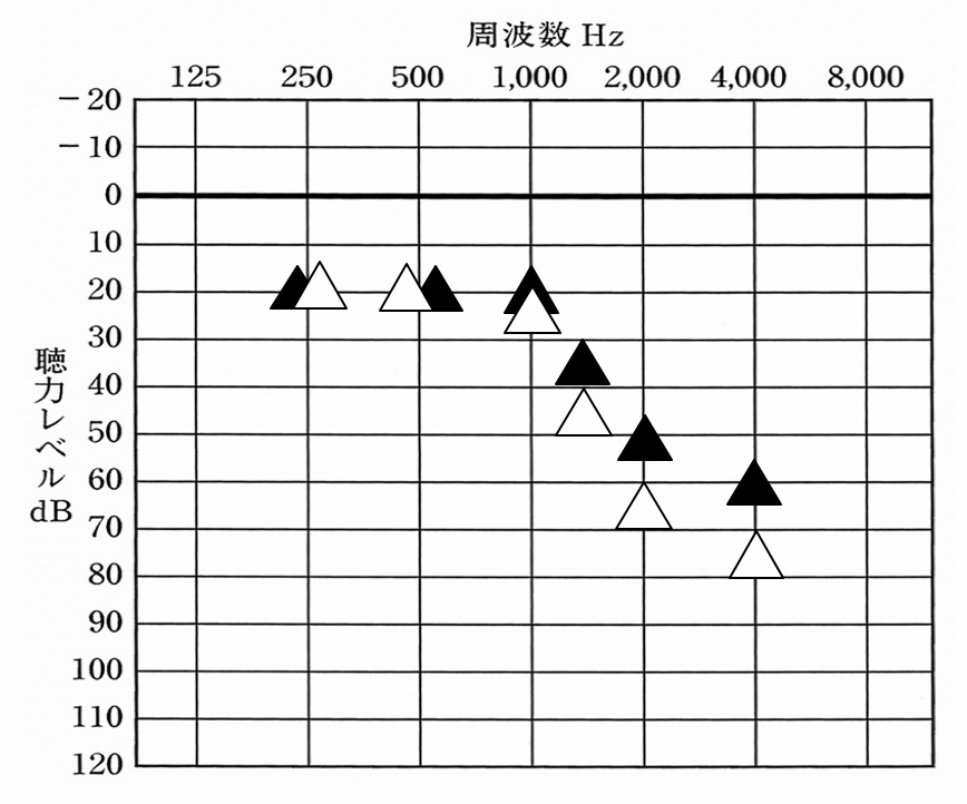 高い音に関しては入れると響きや耳に刺さるような感覚になるため、それは軽減。しかし音声に重要なところだけは、しっかり入れた状態になる。