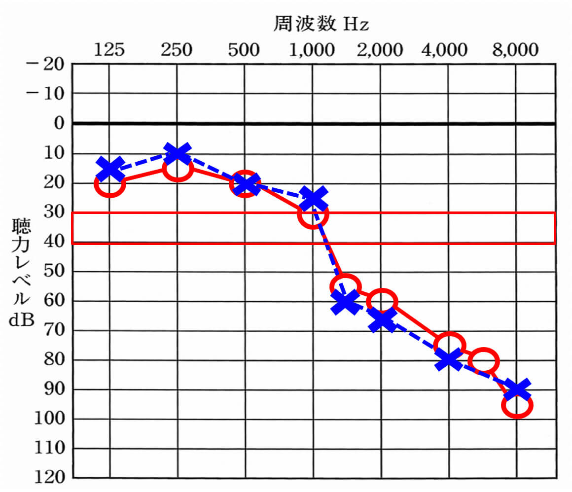 補聴器が補える上限は、大体赤い枠で囲まれた部分となる。それよりも聞こえているところは、良くはできない。