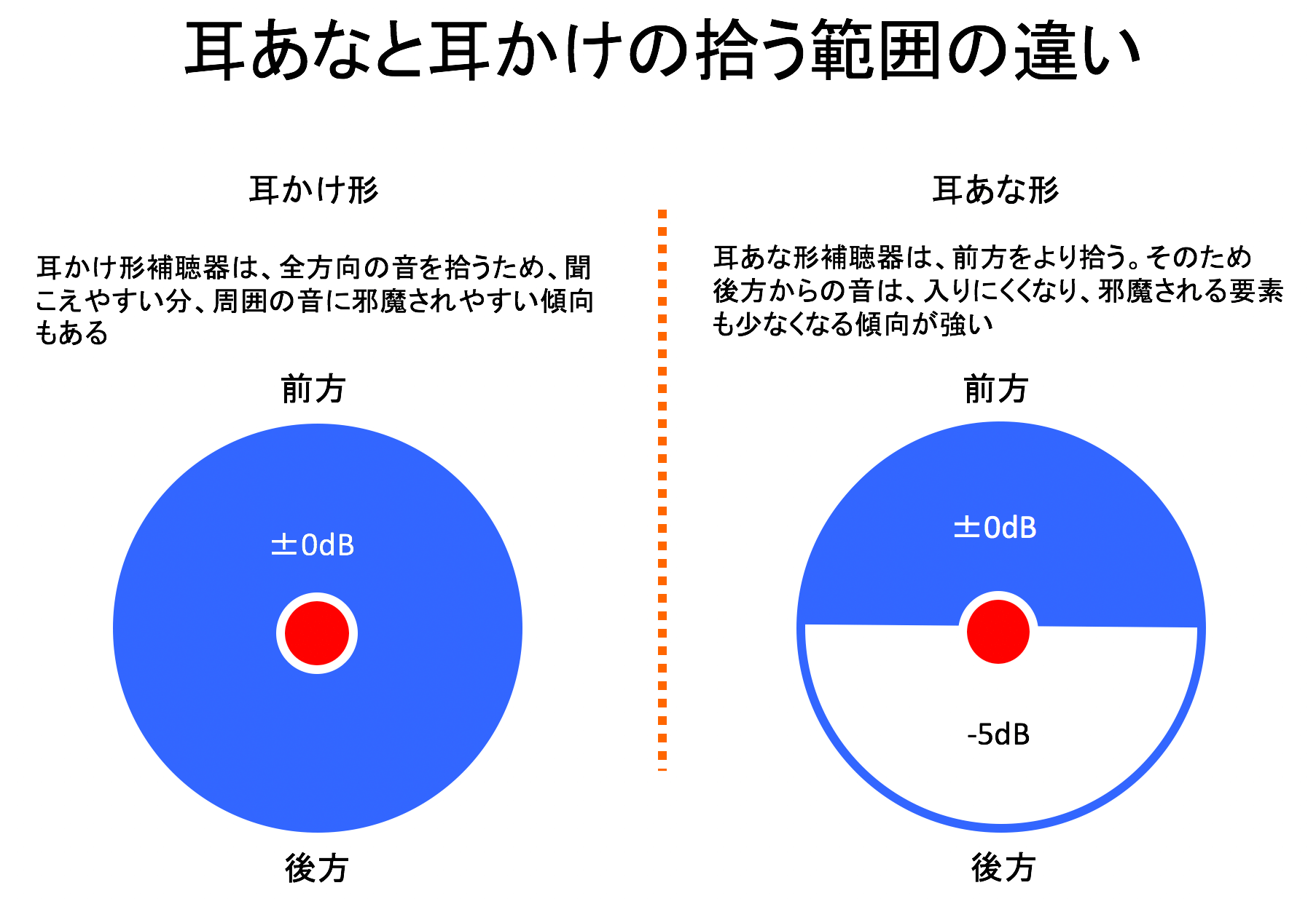形状の違いの一つは、音を拾う範囲。補聴器の効果を決める大きな要素となる。結論を言うと耳あな形の方が聞こえの効果が高いことが多い。