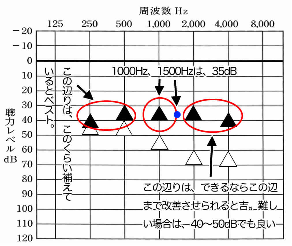 聞こえ改善の目安。軽度〜中等度難聴までは、このように目標値を設定し、聞こえを改善させていく。