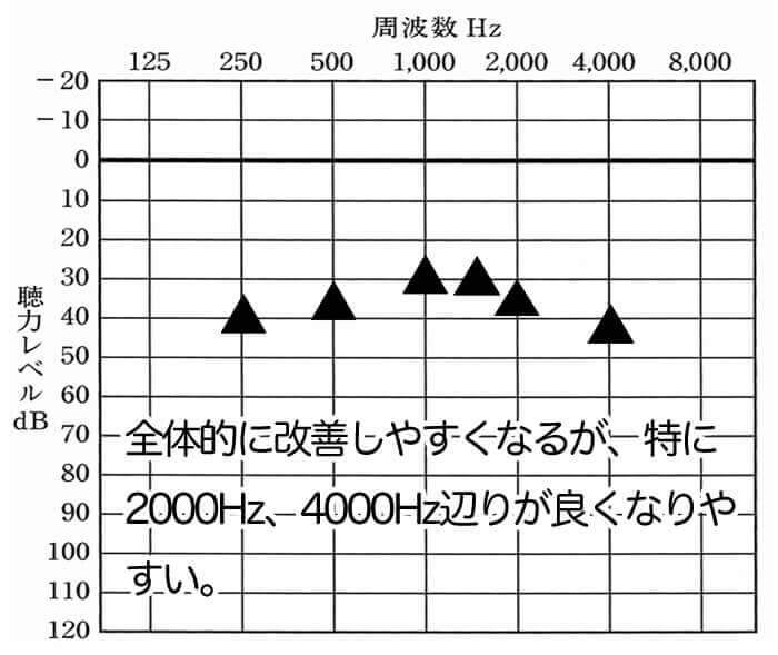 聞こえに関しては、全体的に上がりやすい。1000Hz、1500Hzは、簡単に30dBくらいまでいく。そして、2000Hz、4000Hzも上がりやすい。数値だけを見れば、いいことずくめ。