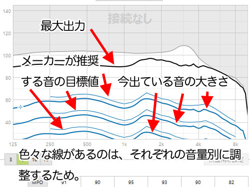 補聴器の調整画面。画面には色々なものがある。最大出力は、音の制限を決め、これ以上、大きな音は出ないようにする部分。非常に重要な部分だ。